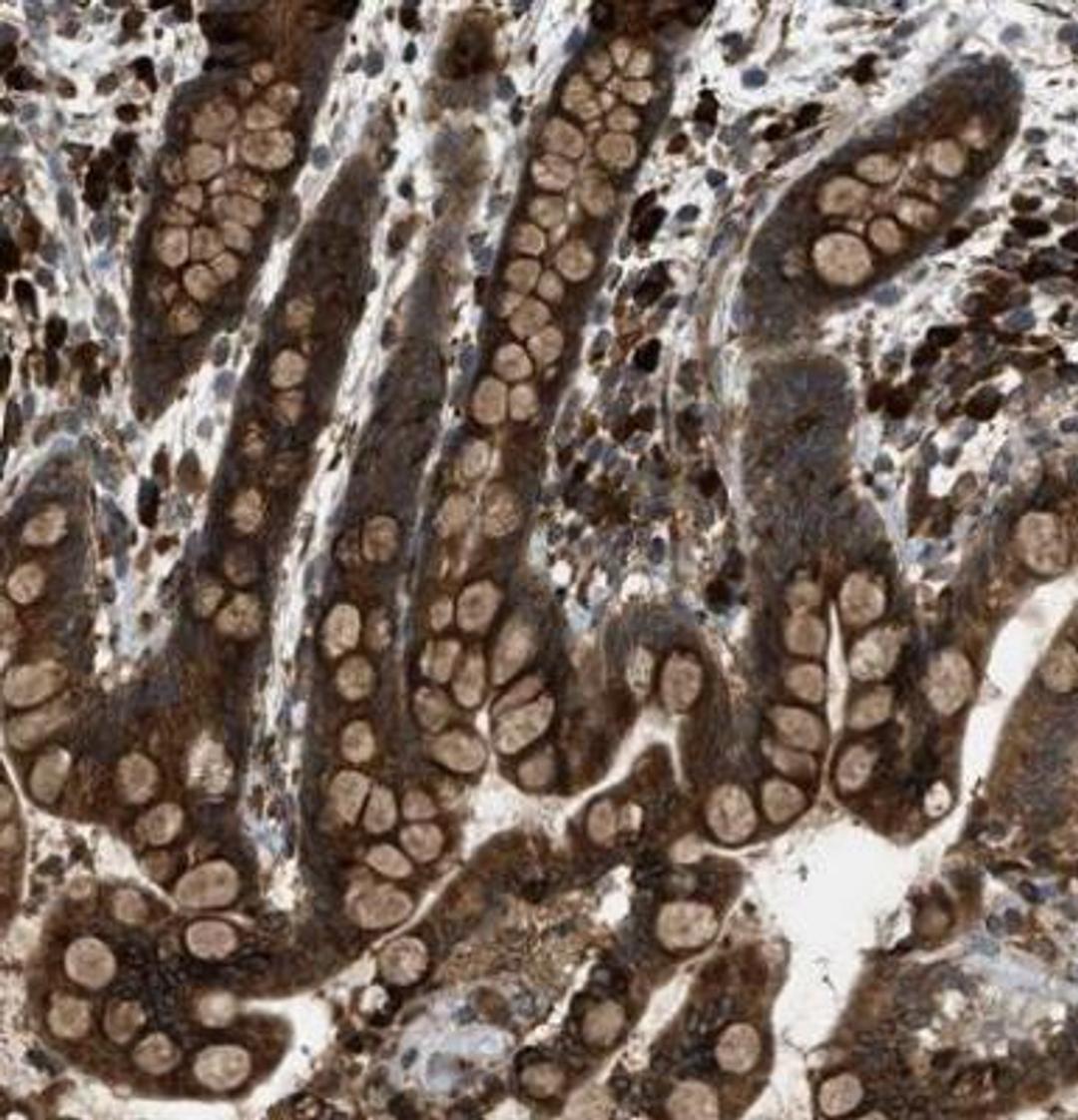 Immunohistochemistry-Paraffin: Protocadherin-18 Antibody [NBP1-81400] - Staining of human colon shows strong positivity in glandular cells.