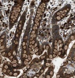 Immunohistochemistry-Paraffin: Protocadherin-18 Antibody [NBP1-81400] - Staining of human colon shows strong positivity in glandular cells.