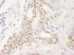 Detection of human DEK by immunohistochemistry.