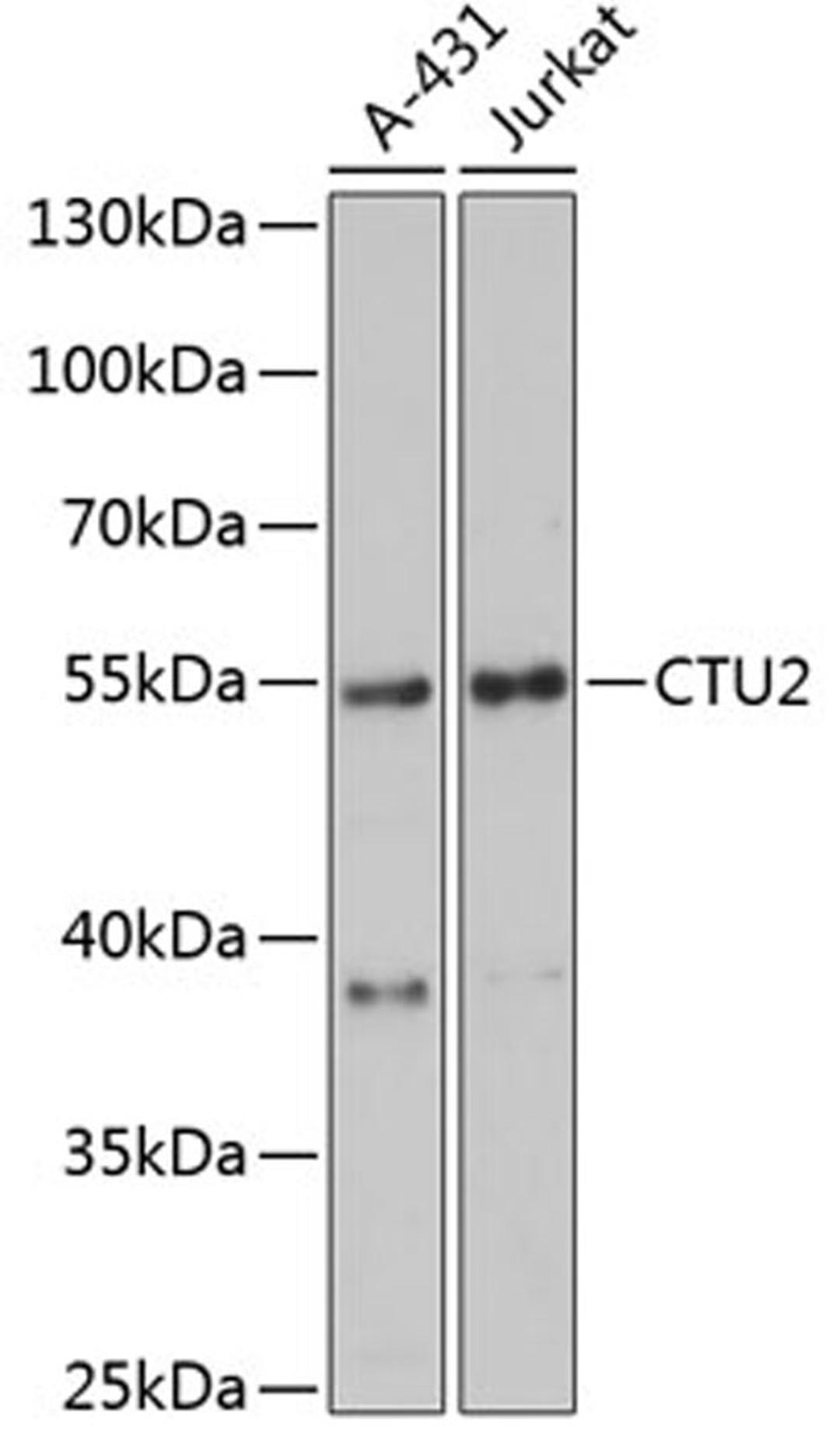 Western blot - CTU2 antibody (A13003)