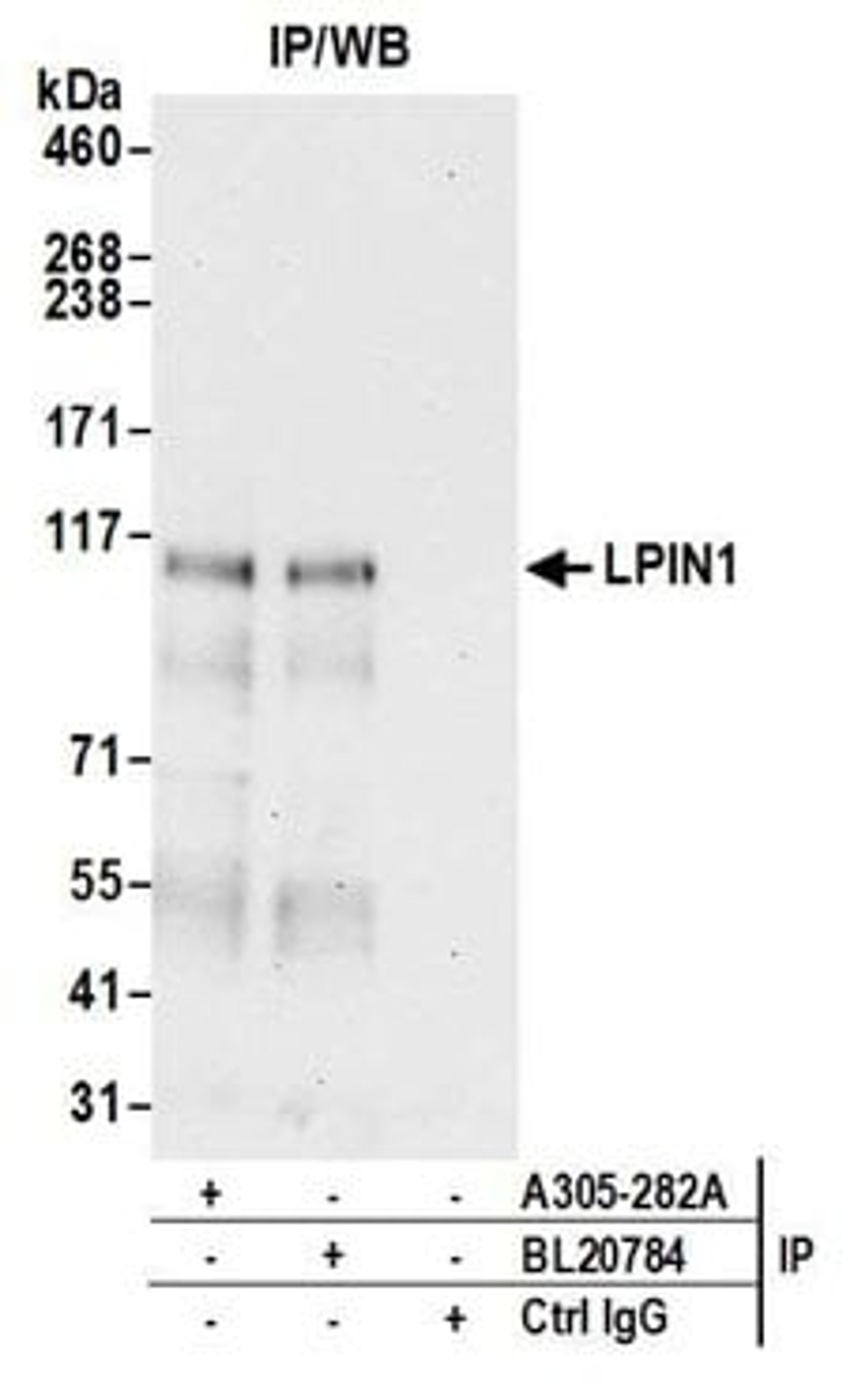 Detection of human LPIN1 by western blot of immunoprecipitates.