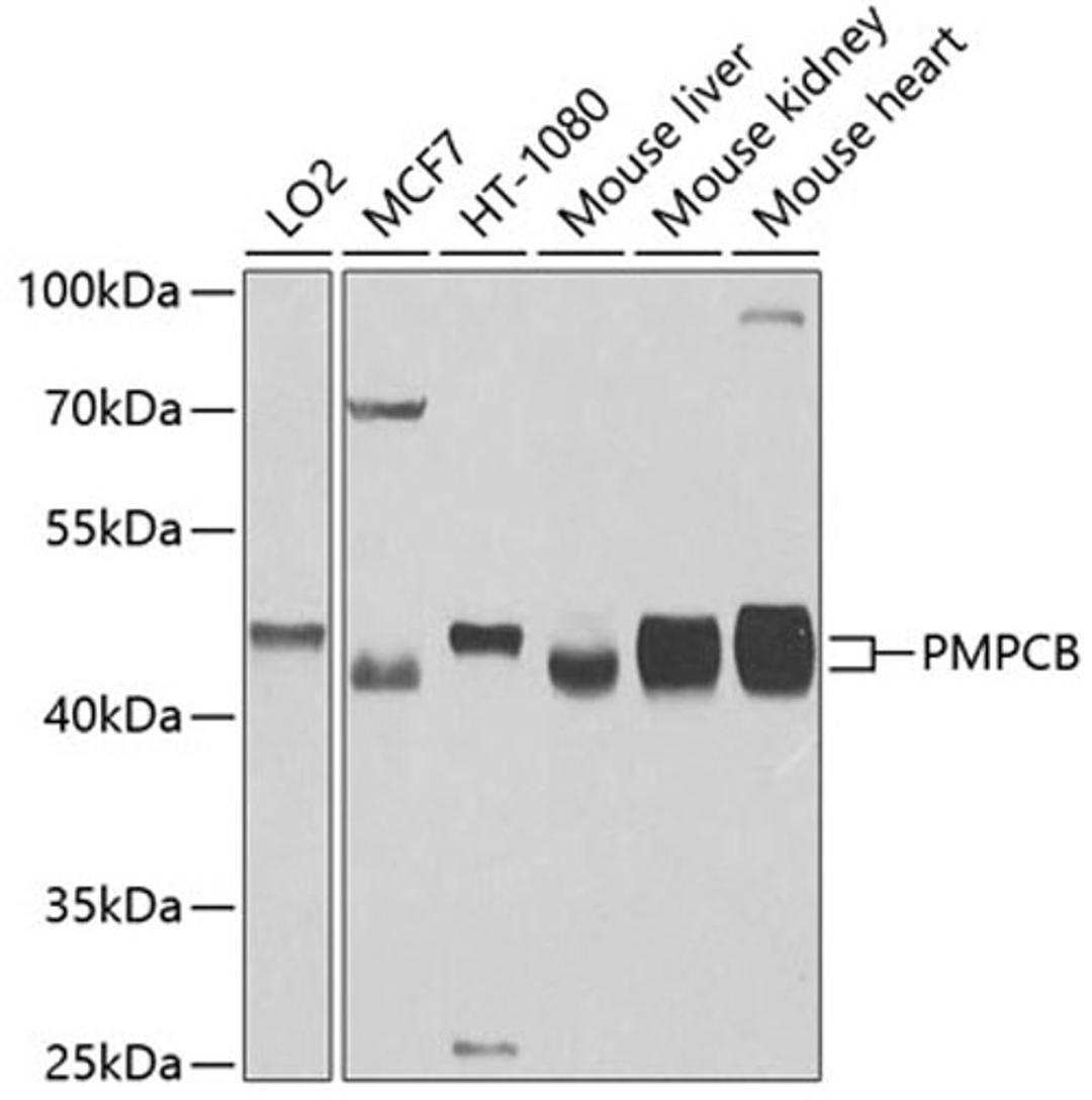 Western blot - PMPCB antibody (A4312)