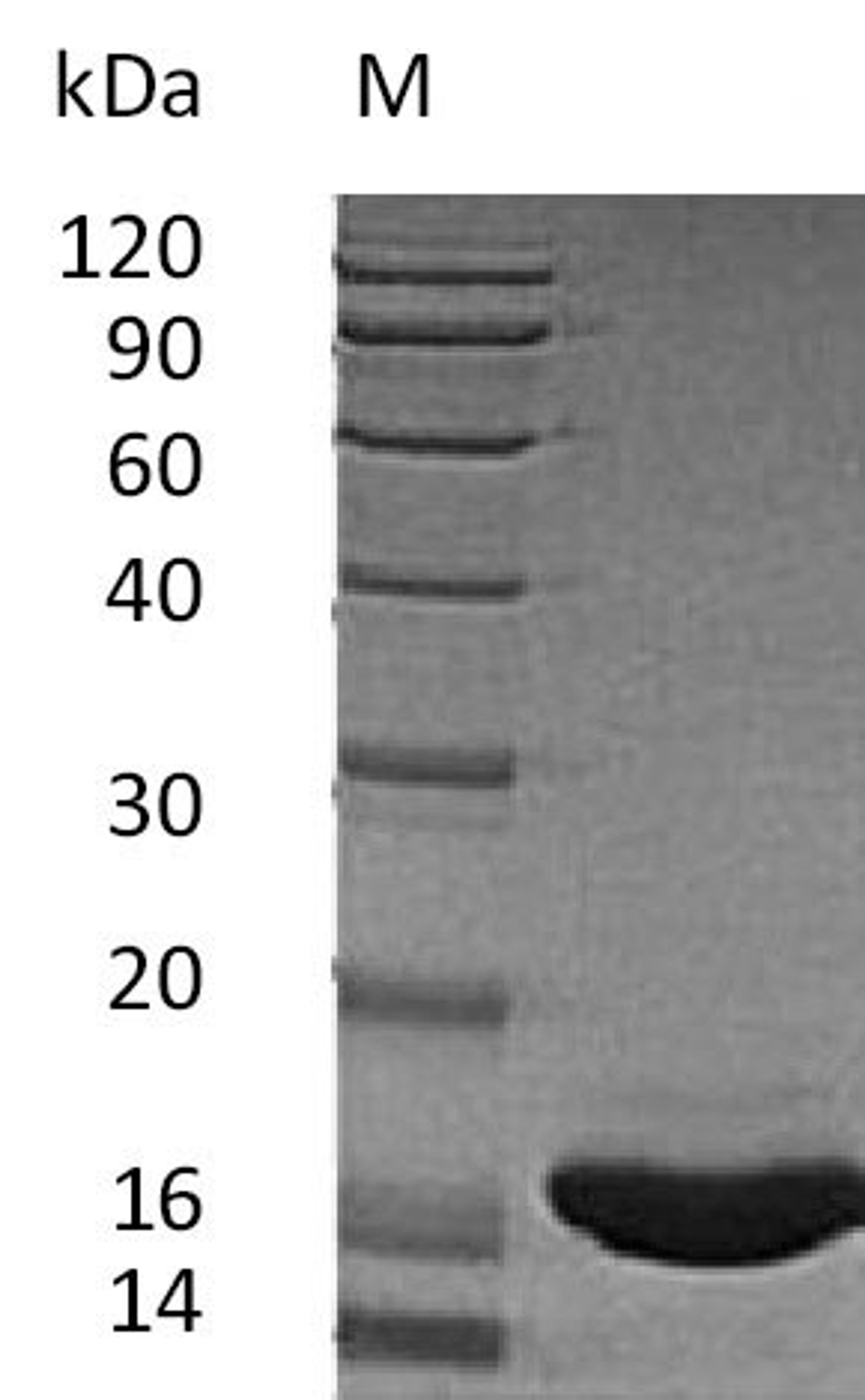 (Tris-Glycine gel) Discontinuous SDS-PAGE (reduced) with 5% enrichment gel and 15% separation gel.