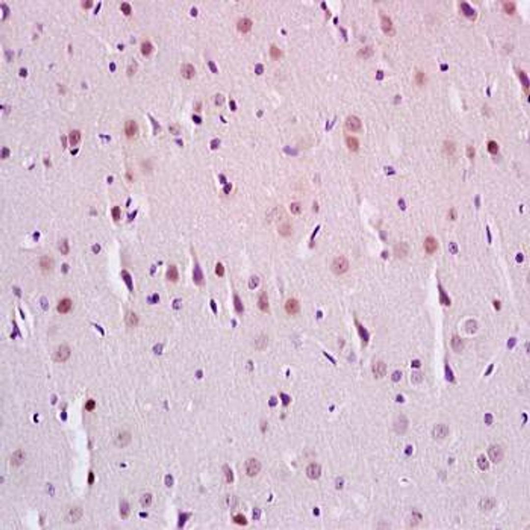 Immunohistochemical analysis of formalin-fixed and paraffin embedded rat brain tissue (Dilution at:1:200) using SirT1 (phospho-Ser47) antibody