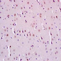 Immunohistochemical analysis of formalin-fixed and paraffin embedded rat brain tissue (Dilution at:1:200) using SirT1 (phospho-Ser47) antibody