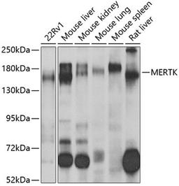 Western blot - MERTK antibody (A5443)