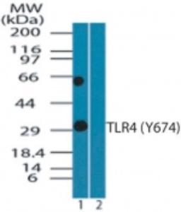 Western Blot: TLR4 [p Tyr674] Antibody [NBP2-24935] - Analysis of phospho TLR4 in (A) recombinant fusion protein containing Tyr674 and (B) fusion partner without the phospho amino acid, using phospho TLR4 antibody at 0.01 ug/ml.