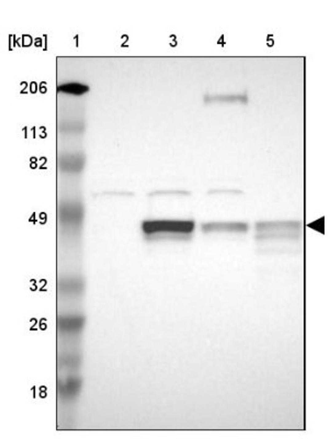 Western Blot: NHERF-2 Antibody [NBP1-84944] - Lane 1: Marker [kDa] 206, 113, 82, 49, 32, 26, 18<br/>Lane 2: Human cell line RT-4<br/>Lane 3: Human cell line U-251MG sp<br/>Lane 4: Human cell line A-431<br/>Lane 5: Human liver tissue