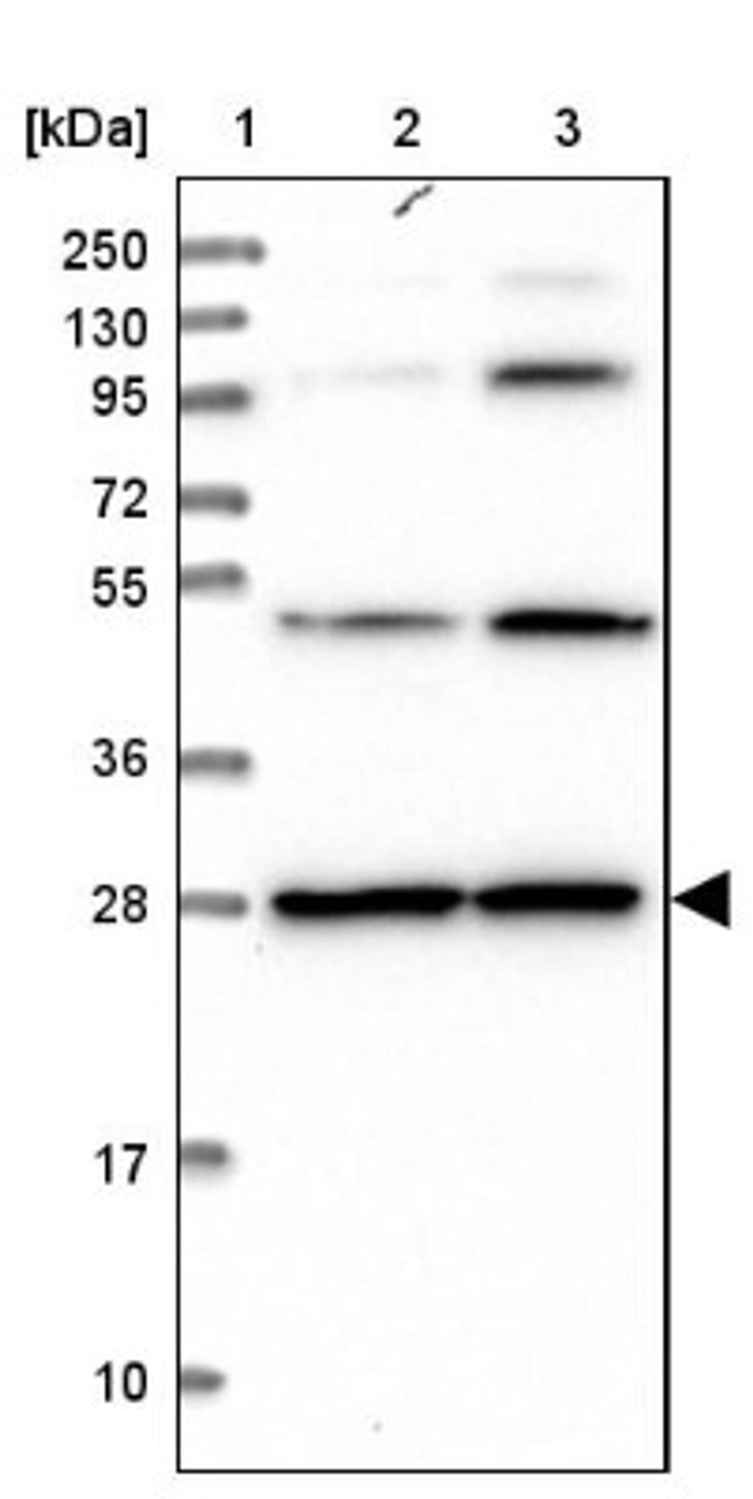 Western Blot: PGLS Antibody [NBP2-47333] - Lane 1: Marker [kDa] 250, 130, 95, 72, 55, 36, 28, 17, 10.  Lane 2: Human cell line RT-4.  Lane 3: Human cell line U-251MG.