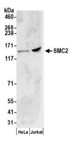 Detection of human SMC2 by western blot.