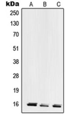 Western blot analysis of HeLa (Lane 1), MCF7 (Lane 2), HEK293 (Lane 3) whole cell lysates using RPL28 antibody