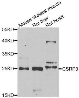 Western blot analysis of extracts of various cell lines using CSRP3 antibody