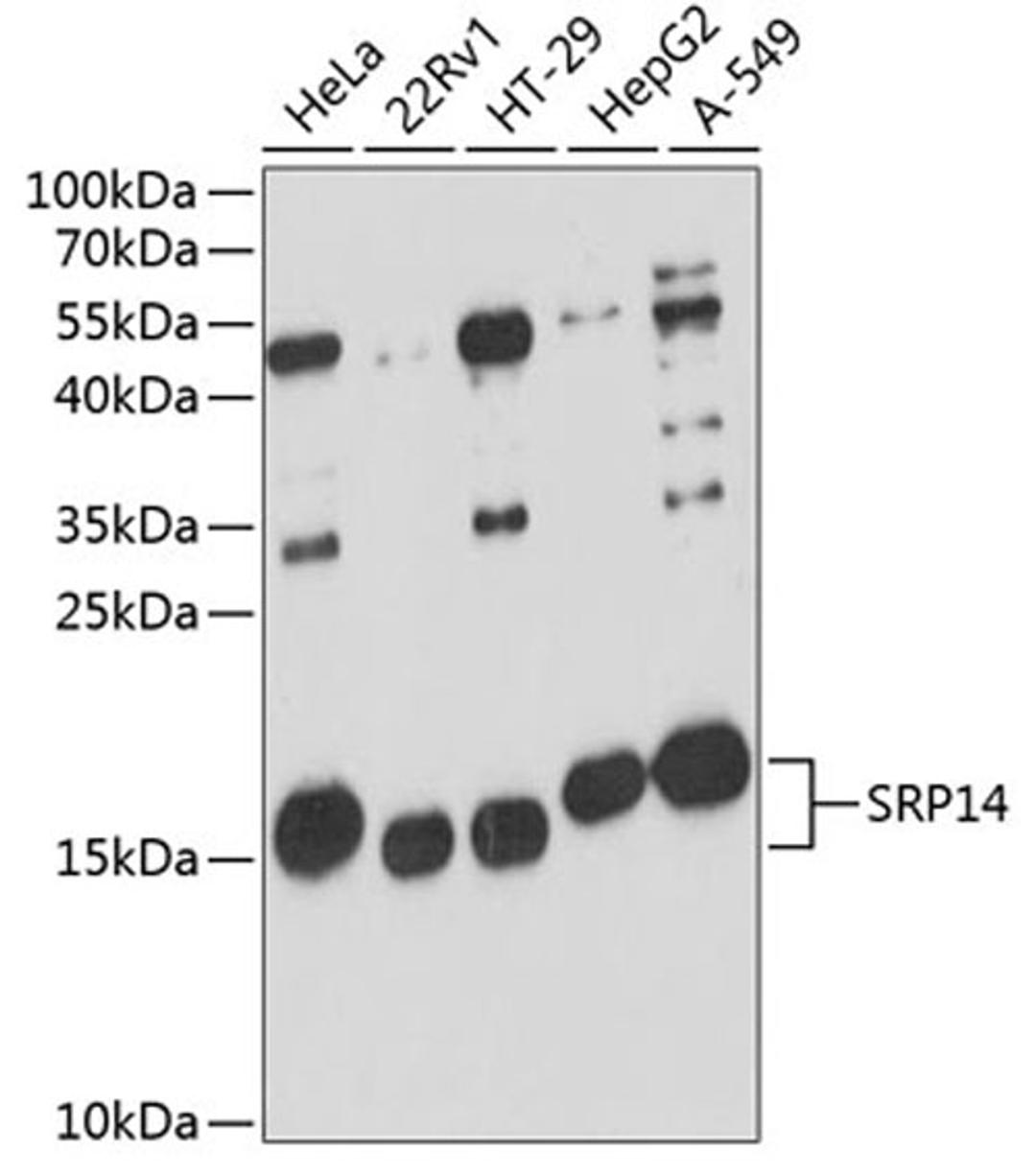 Western blot - SRP14 antibody (A12926)