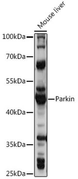 Western blot - Parkin antibody (A11172)