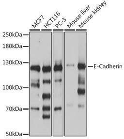 Western blot - E-Cadherin antibody (A16811)