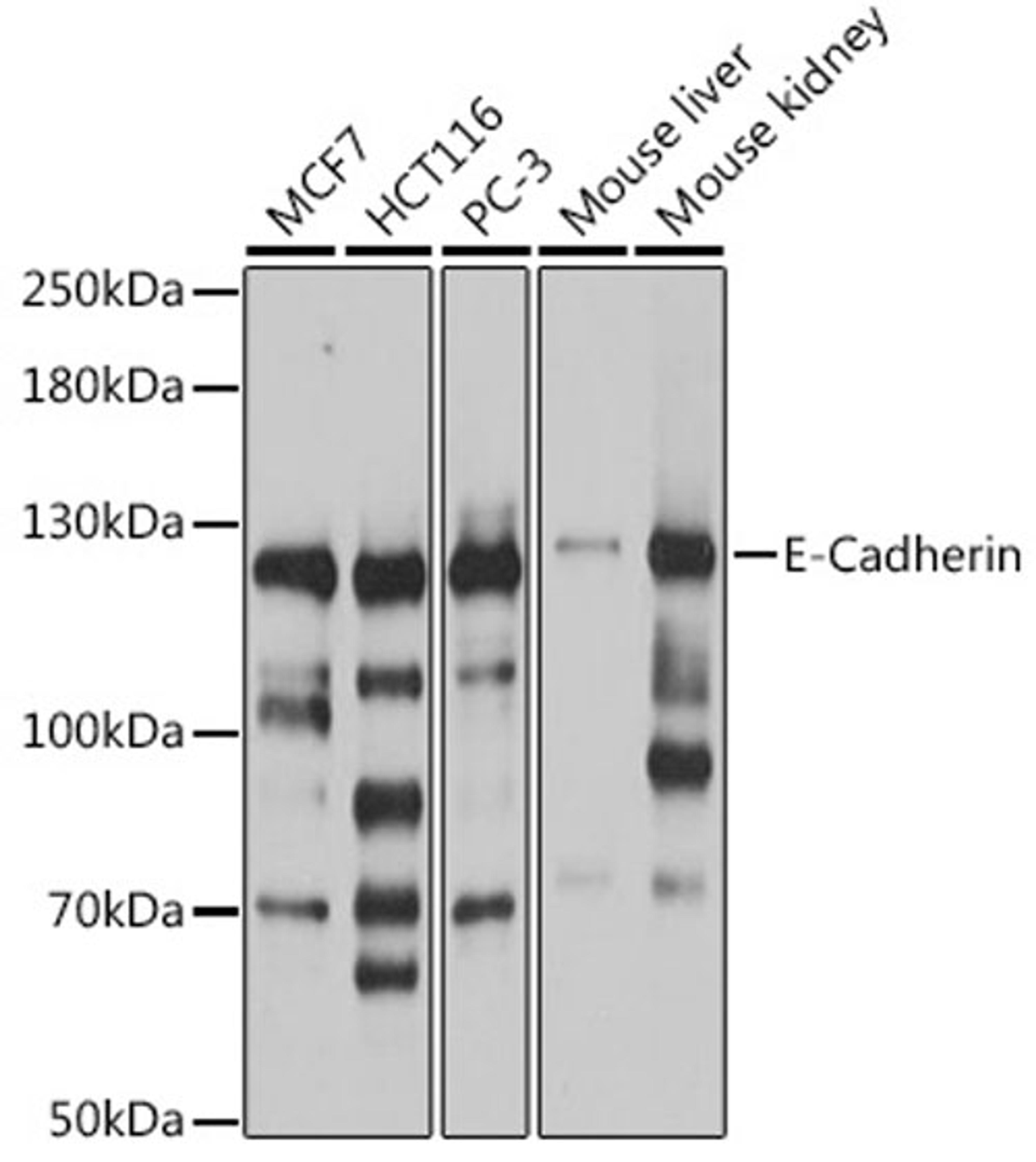 Western blot - E-Cadherin antibody (A16811)