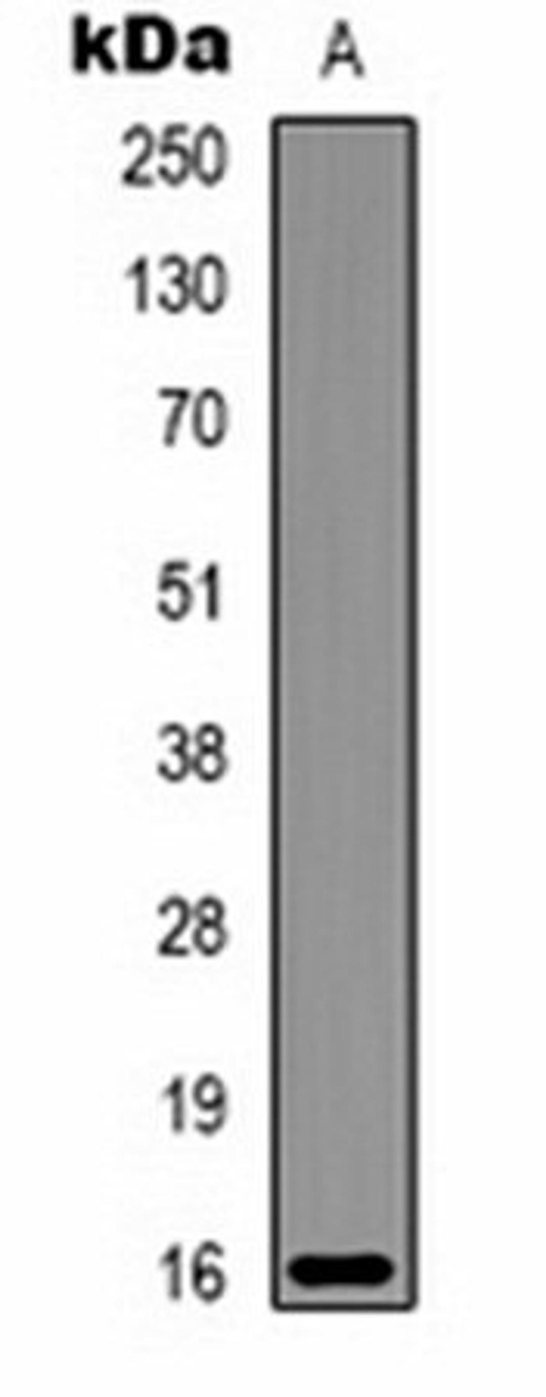 Western blot analysis of Milk (Lane 1) whole cell lysates using Alpha-lactalbumin antibody