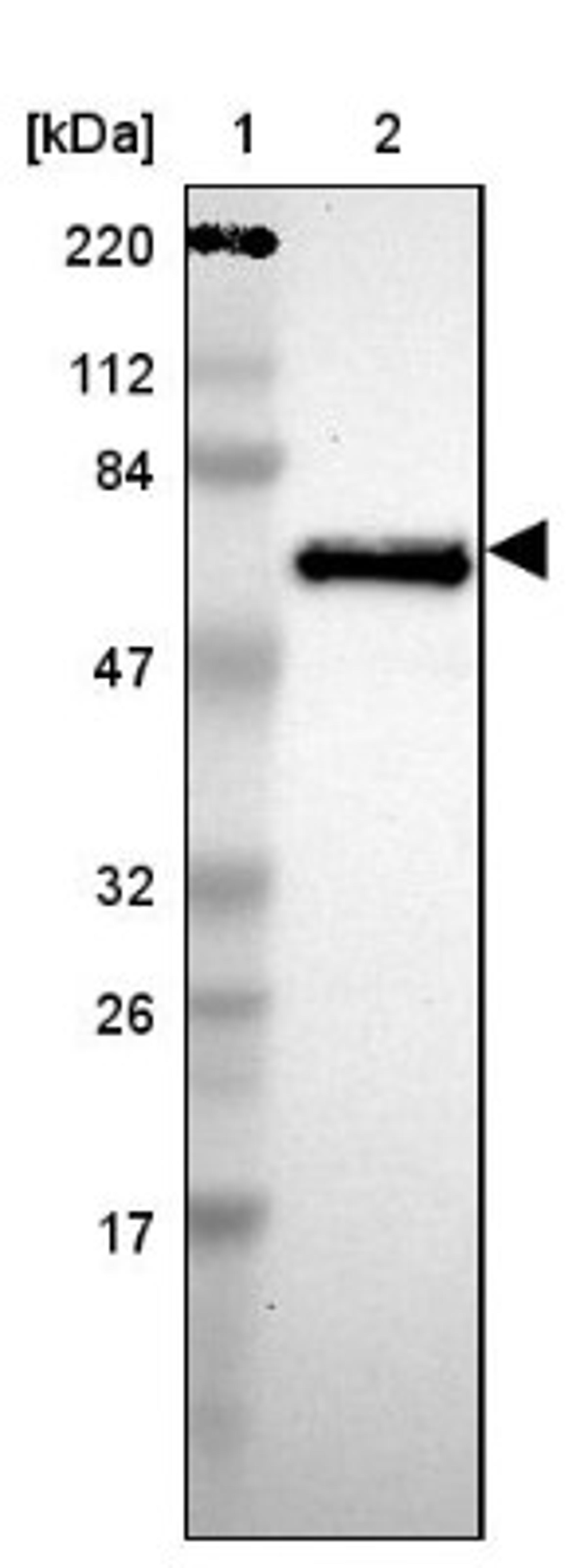 Western Blot: Jaw1 Antibody [NBP1-87724] - Lane 1: Marker [kDa] 220, 112, 84, 47, 32, 26, 17<br/>Lane 2: Human cell line RT-4