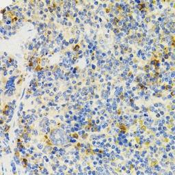 Immunohistochemistry of paraffin-embedded mouse spleen using SH2B1 antibody