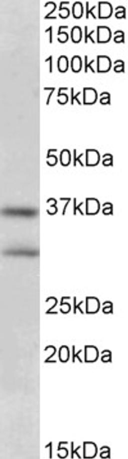 45-588 (0.3ug/ml) staining of Human Brain ( (Hippocampus) lysate (35ug protein in RIPA buffer). Primary incubation was 1 hour. Detected by chemiluminescence.