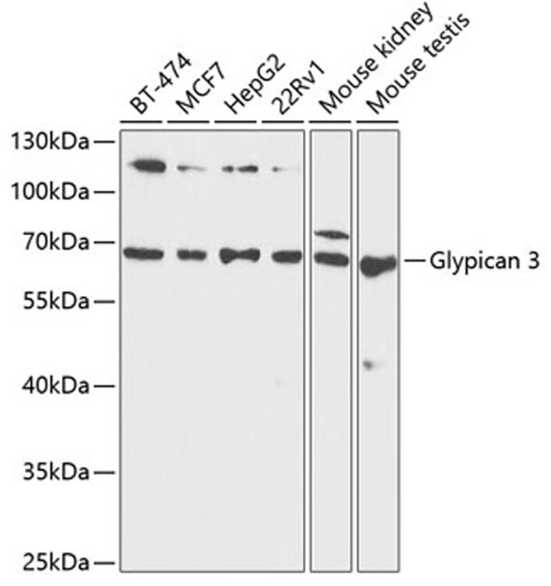 Western blot - Glypican 3 antibody (A1946)