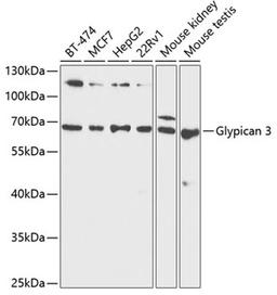 Western blot - Glypican 3 antibody (A1946)