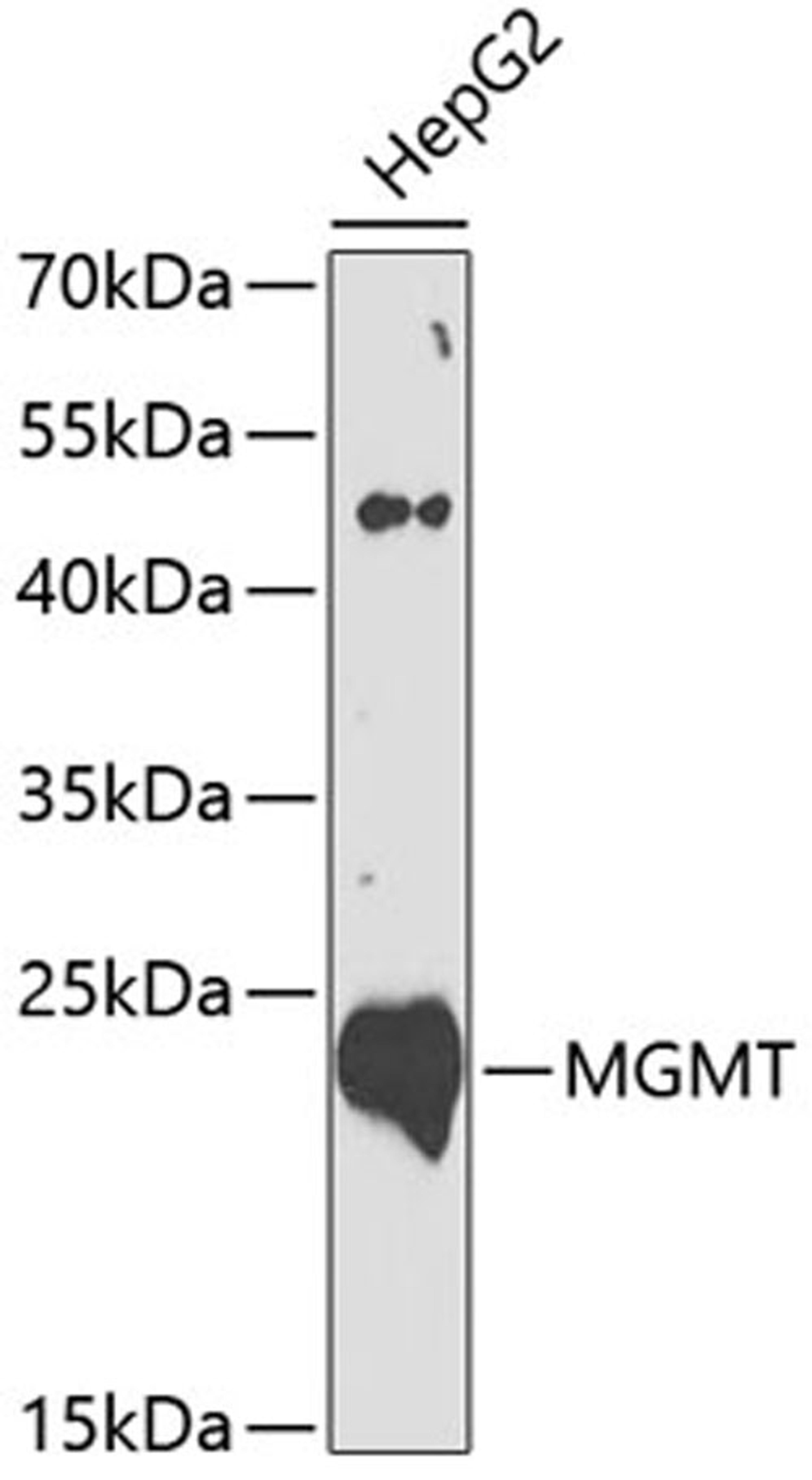 Western blot - MGMT antibody (A0693)