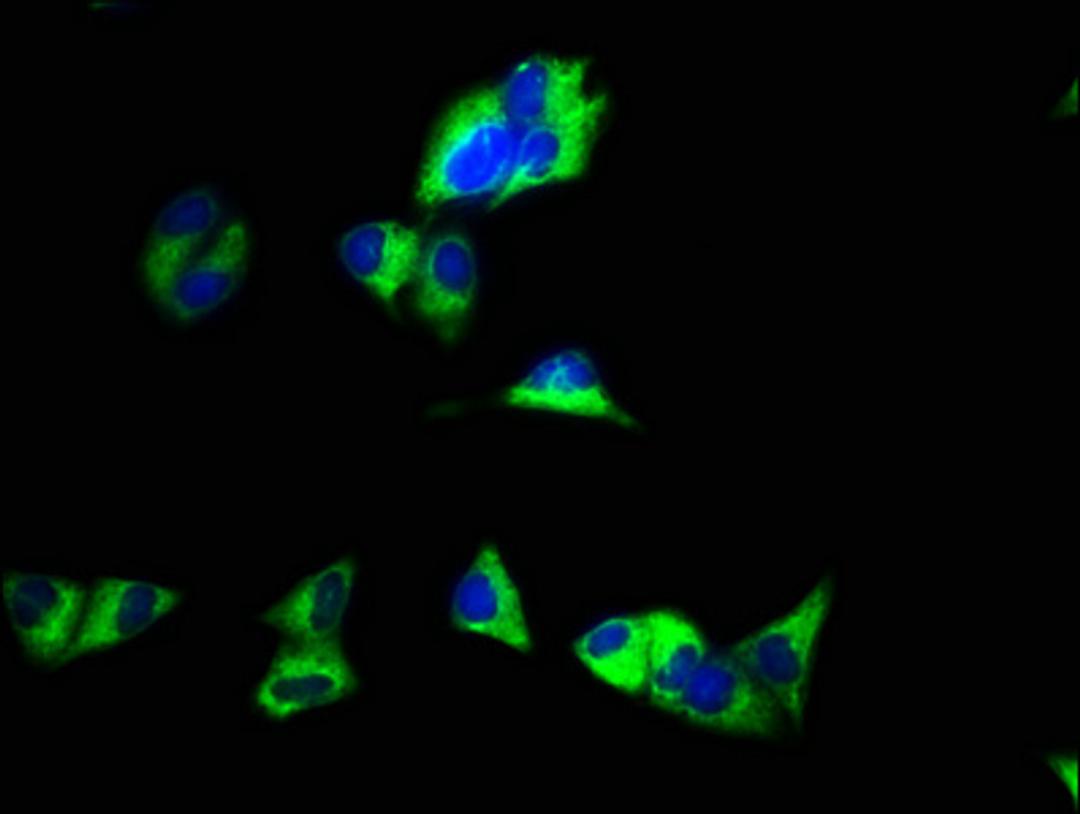 Immunofluorescence staining of Hela cells with CSB-PA009458EA01HU at 1:100, counter-stained with DAPI. The cells were fixed in 4% formaldehyde, permeabilized using 0.2% Triton X-100 and blocked in 10% normal Goat Serum. The cells were then incubated with the antibody overnight at 4&deg;C. The secondary antibody was Alexa Fluor 488-congugated AffiniPure Goat Anti-Rabbit IgG(H+L).