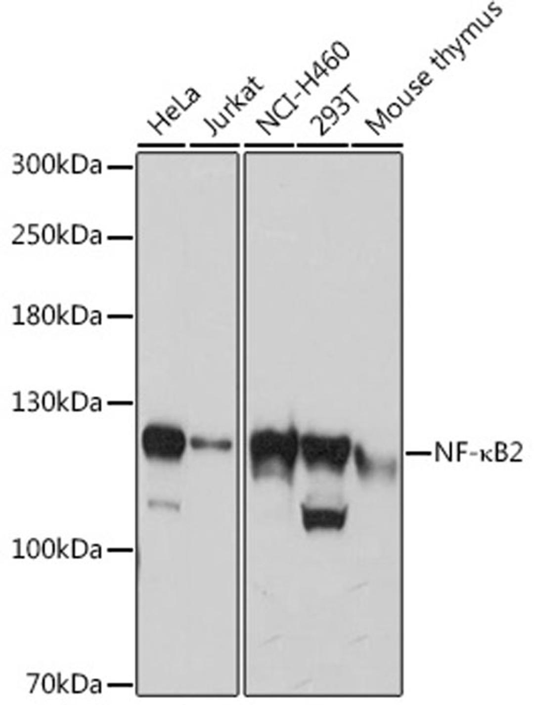 Western blot - NF-?B2 antibody (A3108)