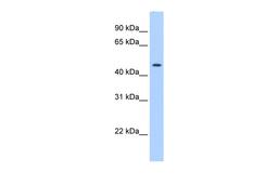 Antibody used in WB on Transfected 293T at 0.2-1 ug/ml.