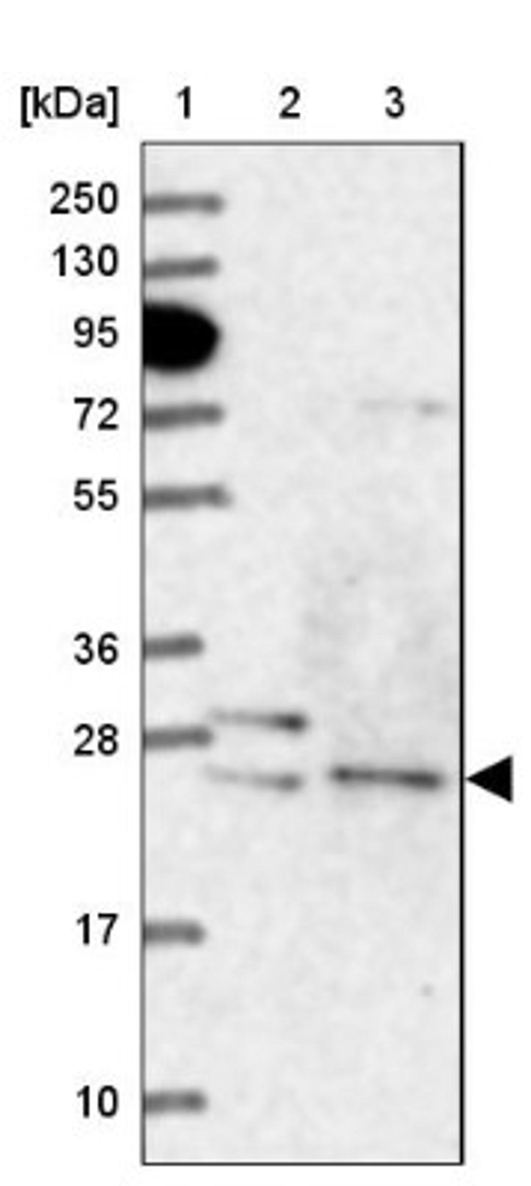 Western Blot: ATG101 Antibody [NBP1-88877] - Lane 1: Marker [kDa] 250, 130, 95, 72, 55, 36, 28, 17, 10<br/>Lane 2: Human cell line RT-4<br/>Lane 3: Human cell line U-251MG sp