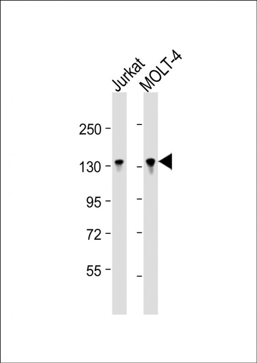 Western Blot at 1:16000 dilution Lane 1: Jurkat whole cell lysate Lane 2: MOLT-4 whole cell lysate Lysates/proteins at 20 ug per lane.