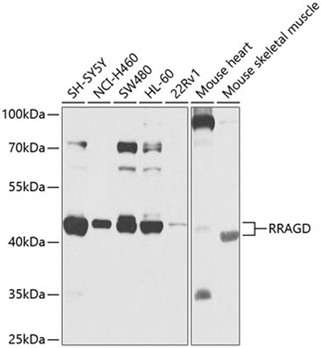 Western blot - RRAGD antibody (A9979)