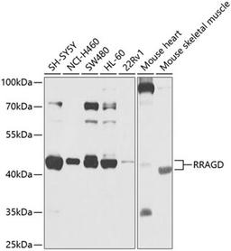 Western blot - RRAGD antibody (A9979)