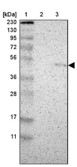 Western Blot: Serine/threonine-protein kinase NIM1 Antibody [NBP2-14254] - Lane 1: Marker [kDa] 230, 130, 95, 72, 56, 36, 28, 17, 11<br/>Lane 2: Human cell line RT-4<br/>Lane 3: Human cell line U-251MG sp