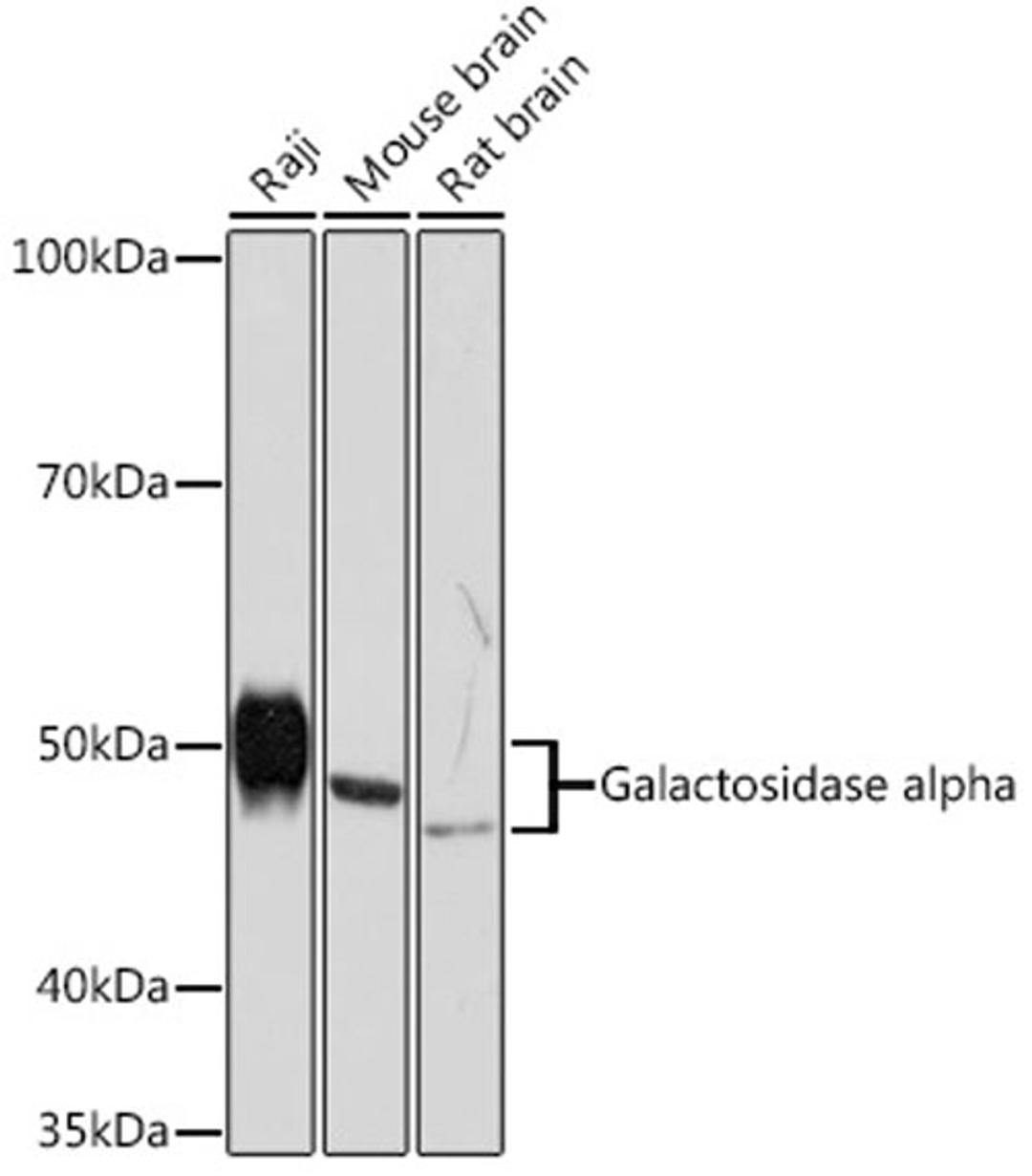 Western blot - Galactosidase alpha Rabbit mAb (A5119)