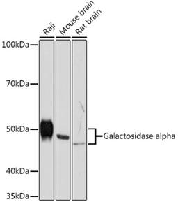 Western blot - Galactosidase alpha Rabbit mAb (A5119)