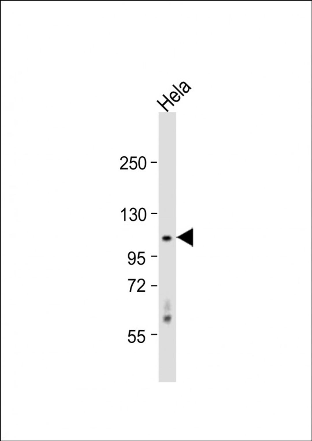 Western Blot at 1:1000 dilution + Hela whole cell lysate Lysates/proteins at 20 ug per lane.