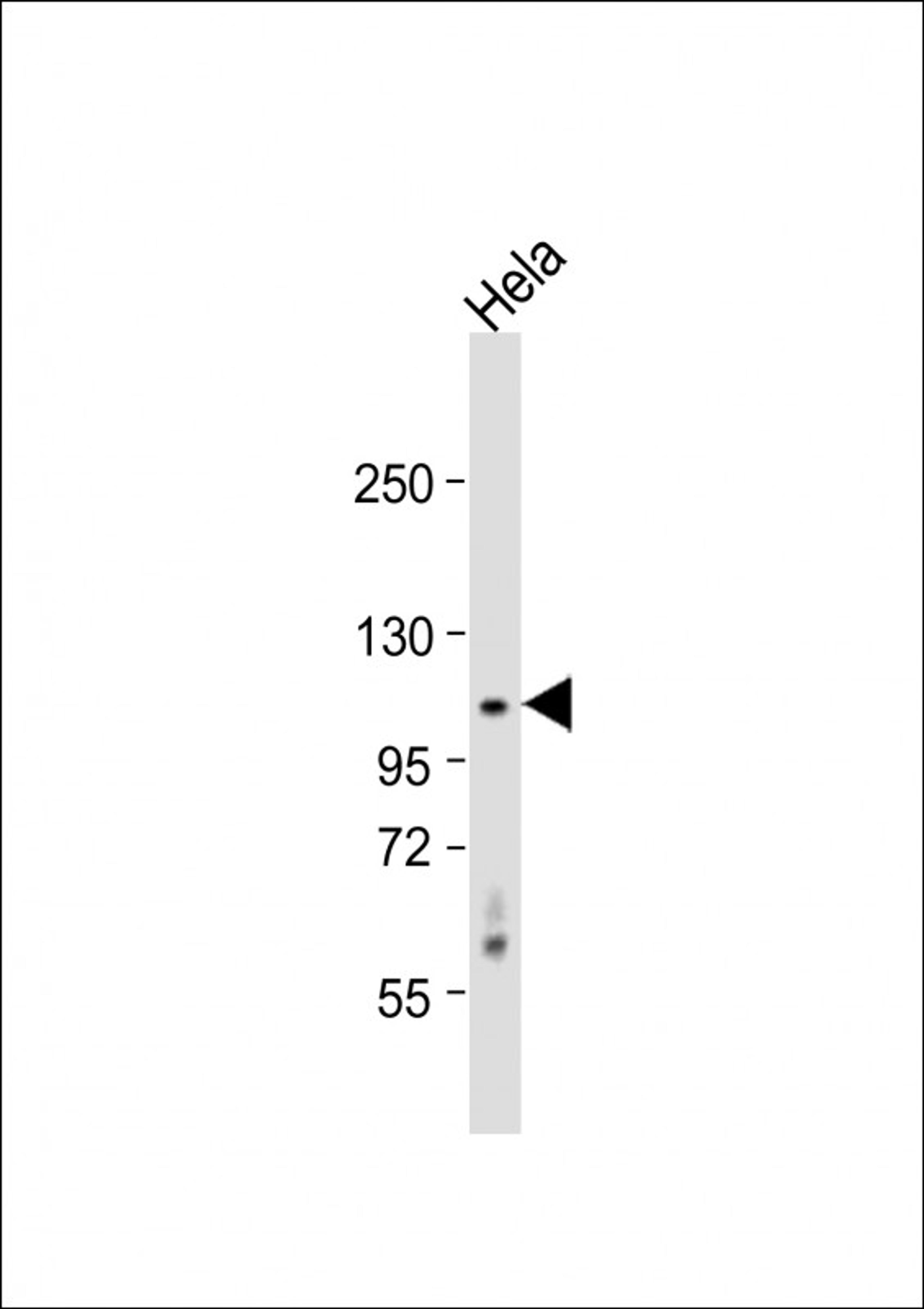 Western Blot at 1:1000 dilution + Hela whole cell lysate Lysates/proteins at 20 ug per lane.