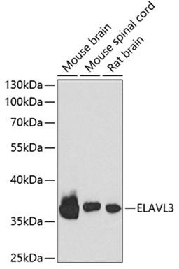 Western blot - ELAVL3 antibody (A6091)