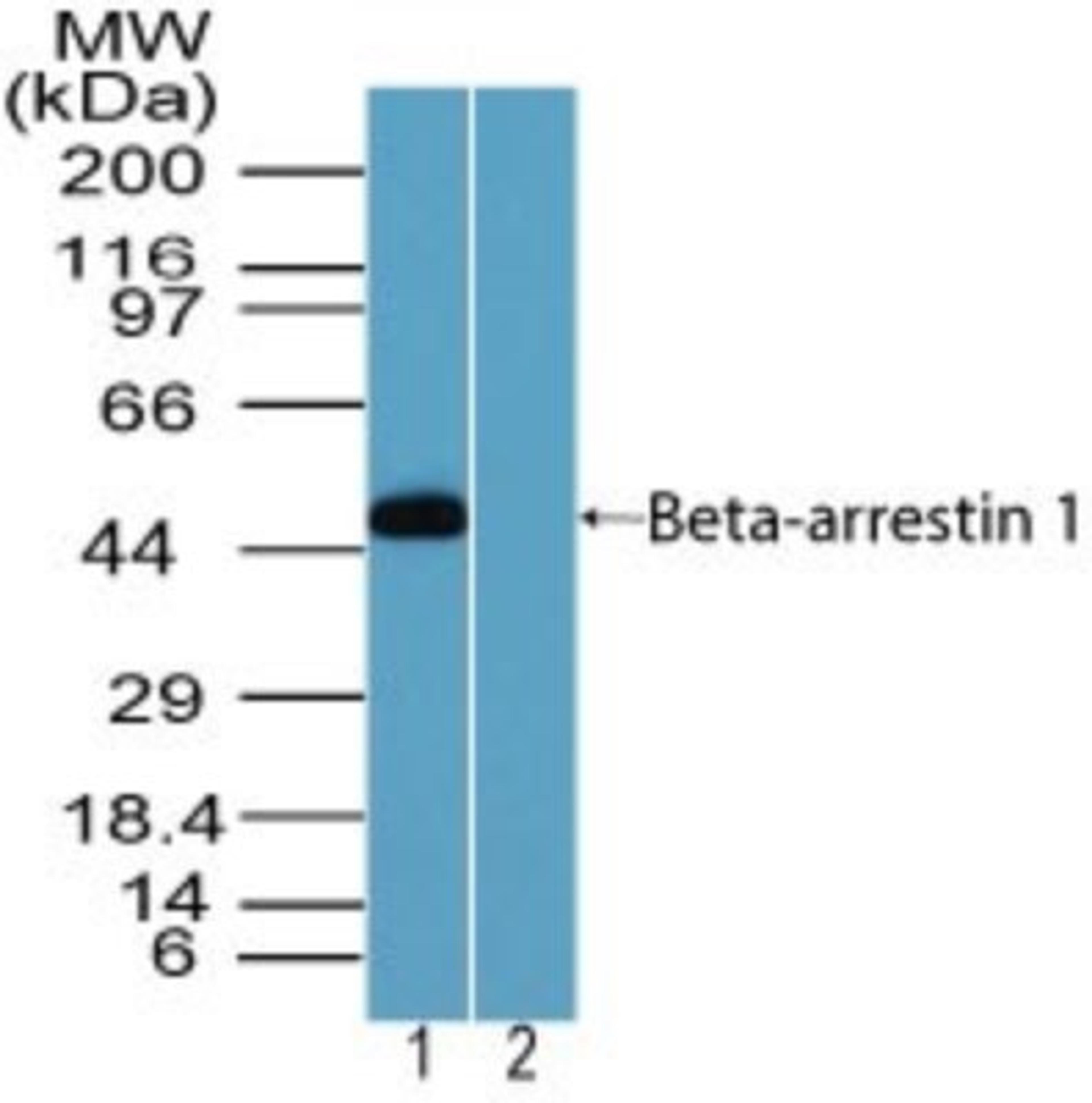 Western Blot: Arrestin beta 1 Antibody [NBP2-24626] - Analysis of Arrestin beta 1 in human testis lysate in the 1) absence and 2) presence of immunizing peptide using NBP2-24626 at 2.0 ug/ml. Goat anti-rabbit Ig HRP secondary antibody and PicoTect ECL substrate solution were used for this test.