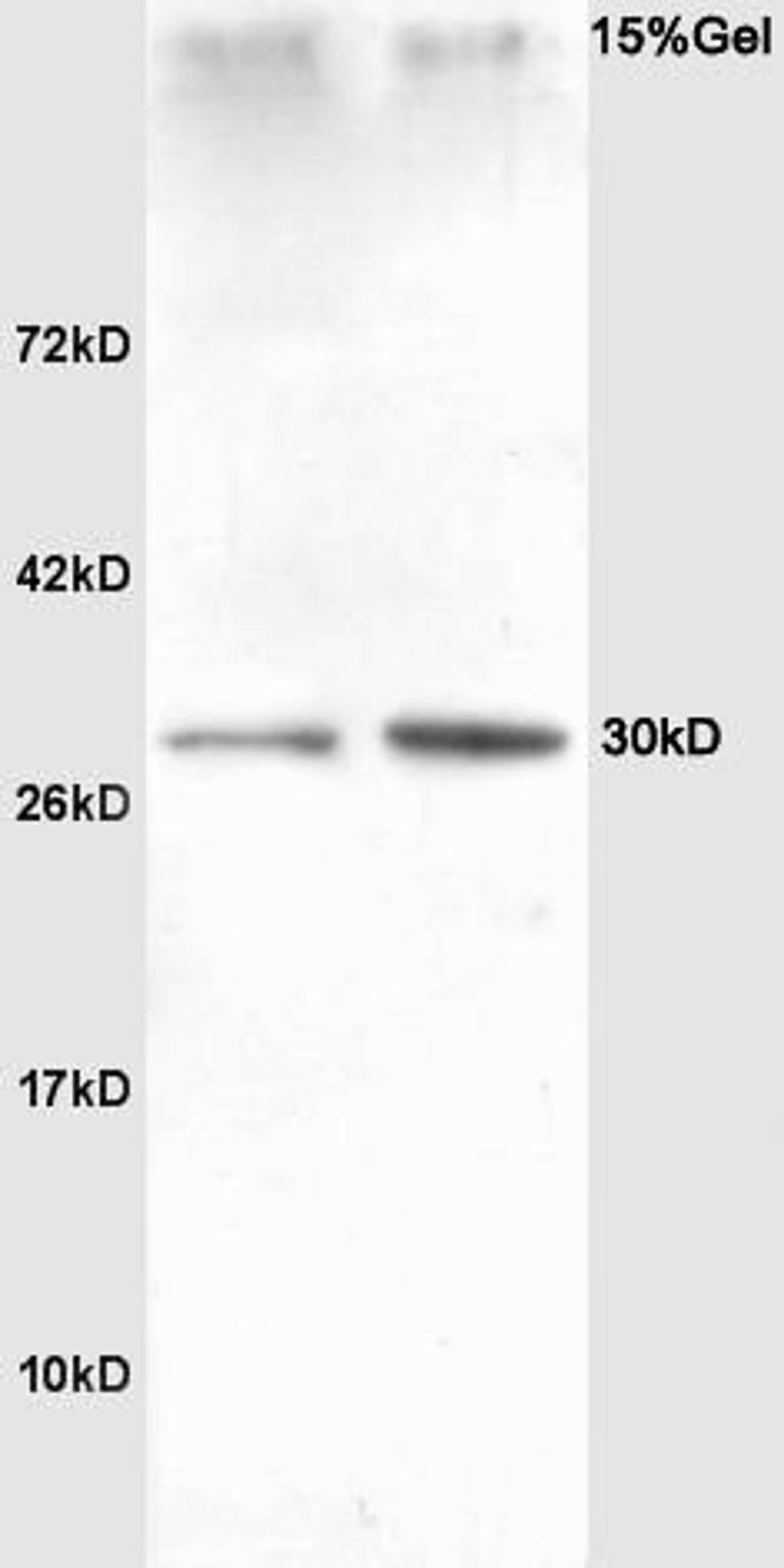 Western blot analysis of rat heart lysates(Lane 1), rat liver lysates (Lane2) using SLUG antibody