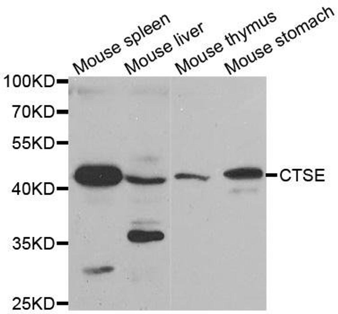 Western blot analysis of extracts of various tissues using CTSE antibody