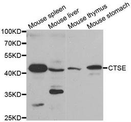 Western blot analysis of extracts of various tissues using CTSE antibody