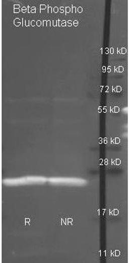 Western blot analysis of under reducing (R) and non-reducing (NR) conditions using Beta-phosphoglucomutase antibody