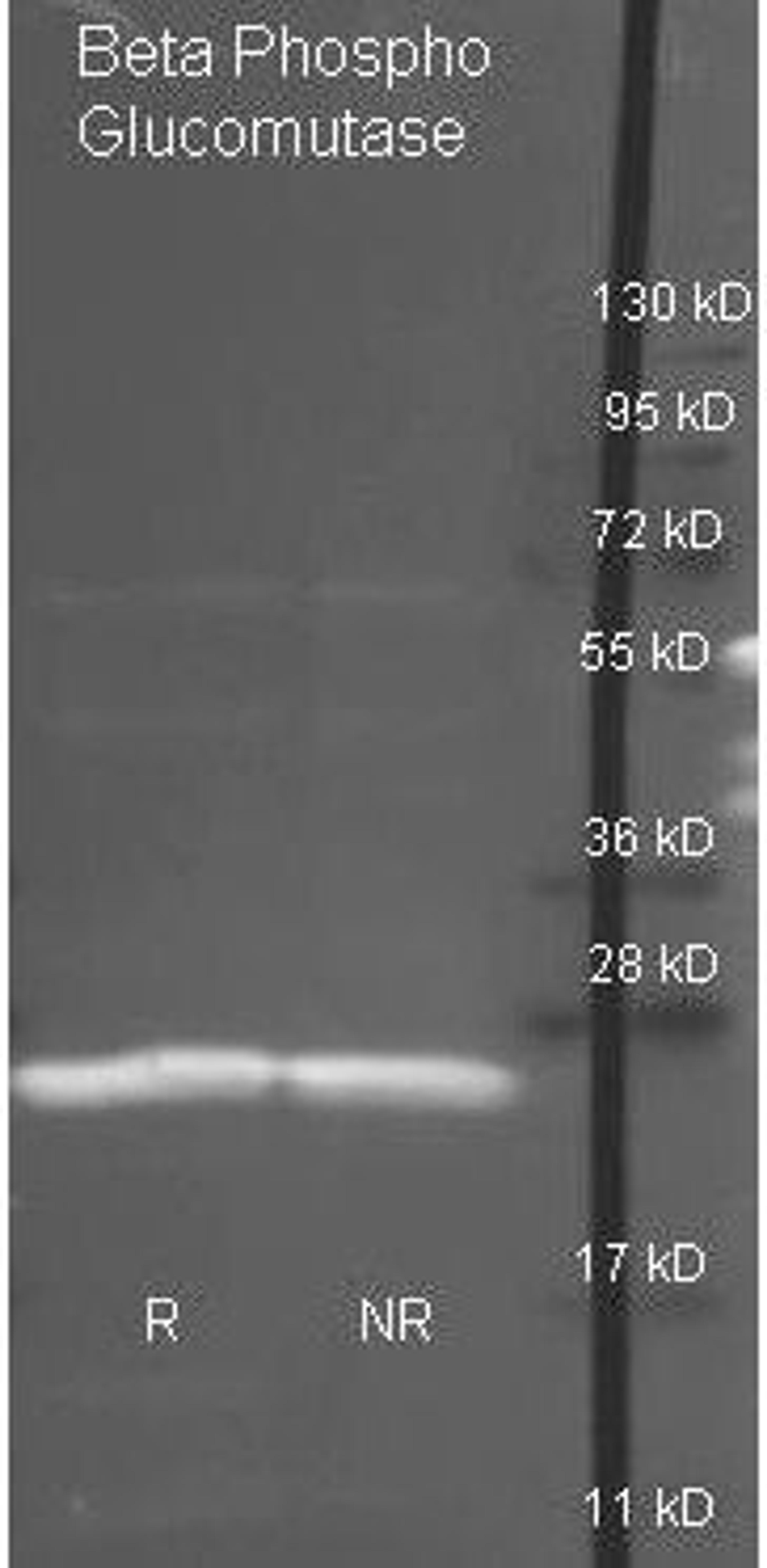 Western blot analysis of under reducing (R) and non-reducing (NR) conditions using Beta-phosphoglucomutase antibody