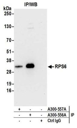 Detection of human RPS6 by western blot of immunoprecipitates.