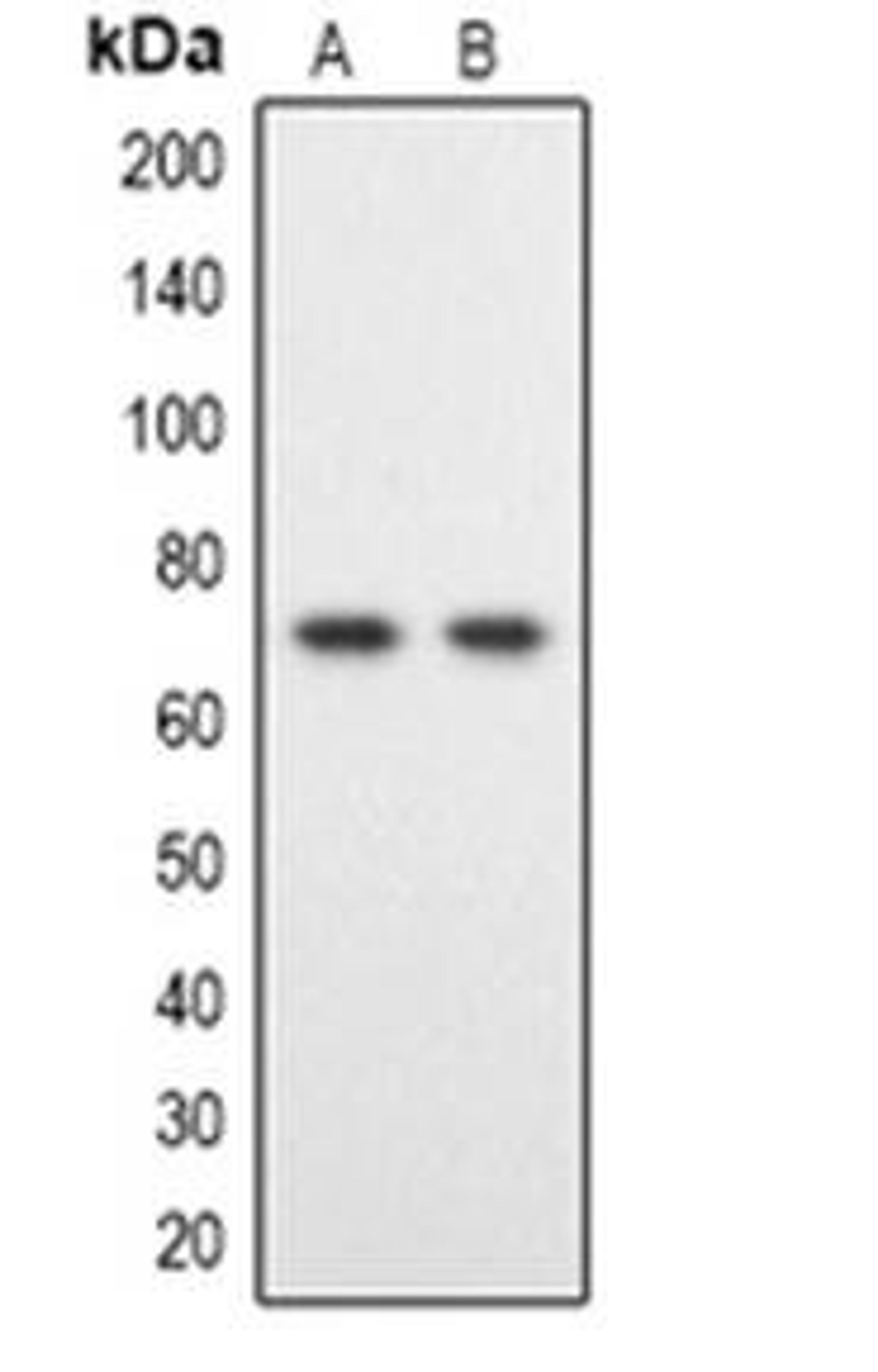 Western blot analysis of DYRK1B expression in Hela (Lane 1), HT1080 (Lane 2) whole cell lysates using DYRK1B antibody