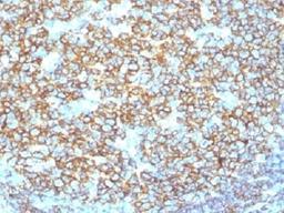 IHC testing of recombinant CD20 antibody and FFPE human tonsil tissue. Required HIER: steam section in pH6 citrate buffer for 20 min.