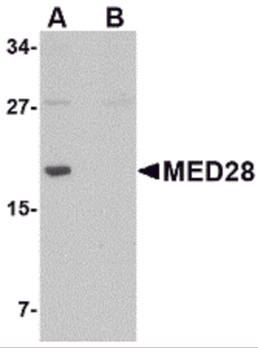 Western blot analysis of MED28 in human brain tissue lysate with MED28 antibody at 1 μg/mL in (A) the absence and (B) the presence of blocking peptide.